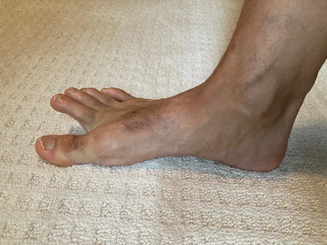 demonstrating exercise to work on foot proprioception and strengthen the toe flexors